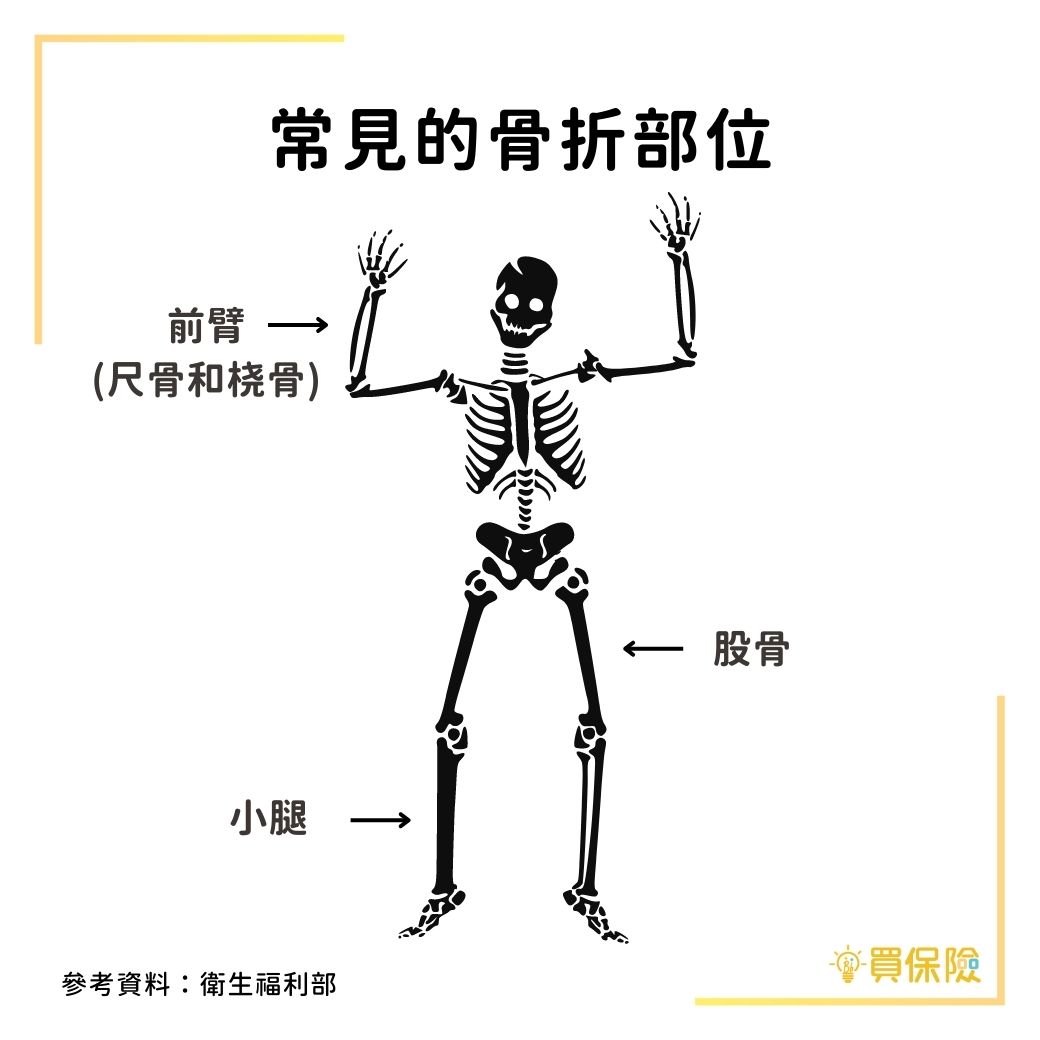 2021年衛福部統計的常見骨折部位：前臂、股骨以及小腿